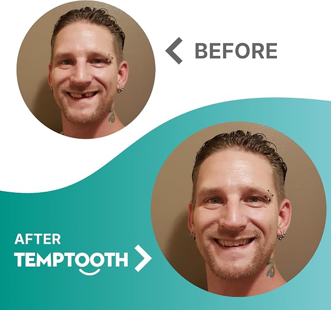Temptooth Tooth Replacement Product with Coloring Material