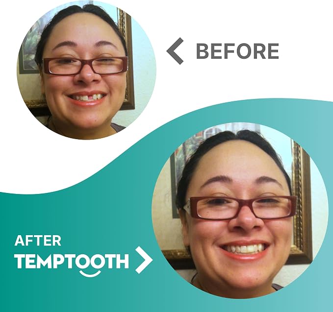 Temptooth Tooth Replacement Product with Coloring Material